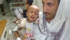 بسبب العدوان: 3 آلاف طفل يمني مريض يواجهون الموت