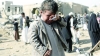 ۸۰ ہزار یمنی بیمار سعودی و امریکی حکام کی بھینٹ چڑھ گئے